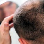 गंजेपन की समस्या से निजात दिलाने लाया गया……………हेयर ग्रोथ सीरम